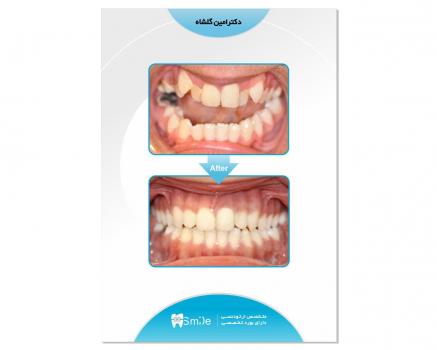 نمونه کار ها