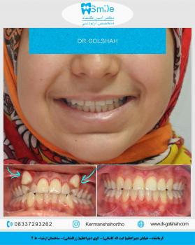 درمان ارتودنسی