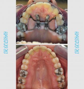نمونه کار ارتودنسی 